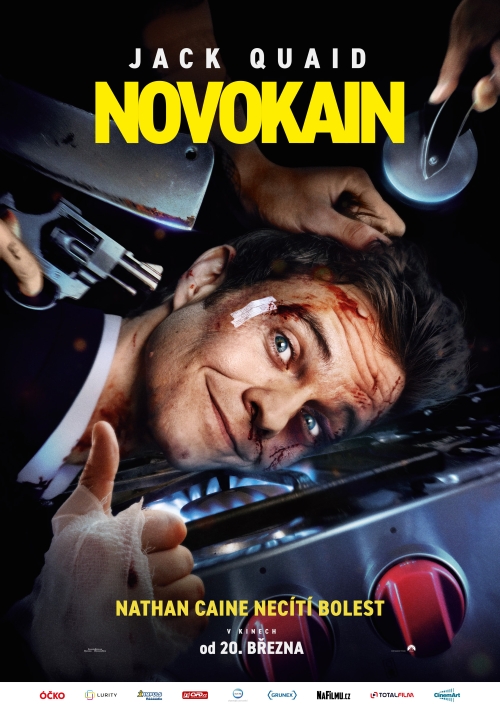 NOVOKAIN